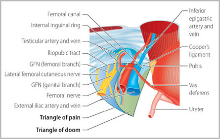 Triangle Of Doom Hernia