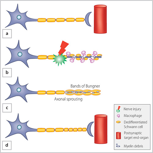 Peripheral Nerve Regeneration Diagram