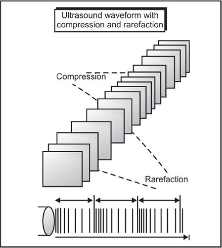 Rarefaction Ultrasound Physics