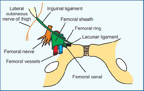 Femoral Ring Boundaries