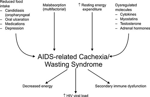 Human Cachexia Cachexia In Hiv Patients