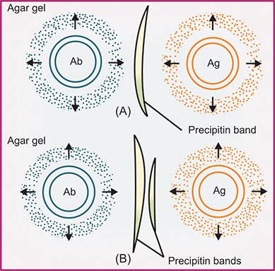 Postzone Precipitation Reaction Of Antigen And Antibody