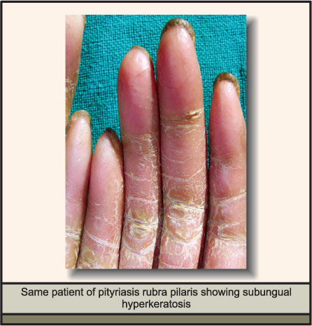 Chexiyalik juftliklar porno suratga olishlarini tomosha qilish