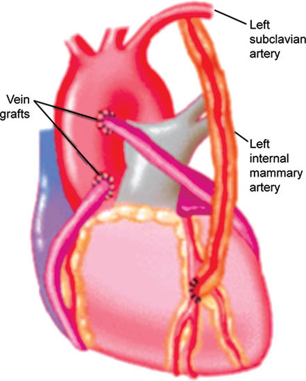 Lima Artery Anatomy JaypeeDigital | EBook Reader
