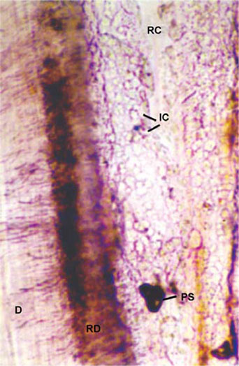 Interglobular Dentin Slide