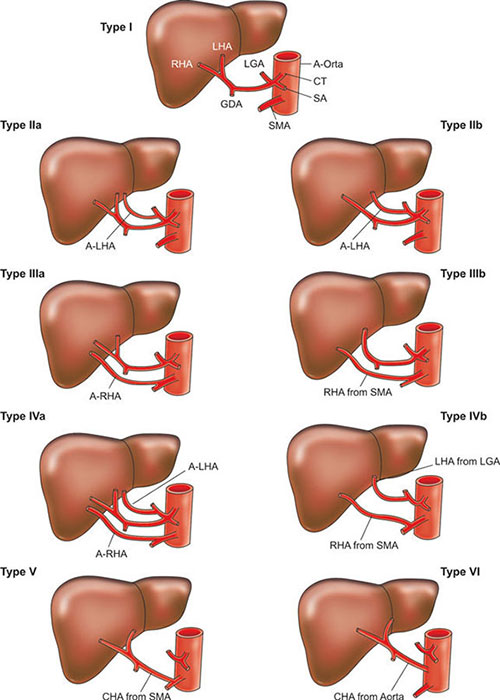 Hepatic Artery Proper Origin