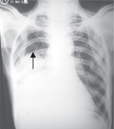 Jaypeedigital Ebook Reader Jaypeedigital Ebook Reader