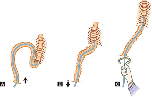 Long Looping Colon