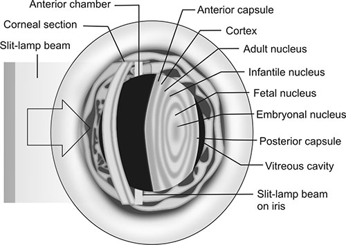 Slit Lamp Function Slit Lamp Eye Diagram