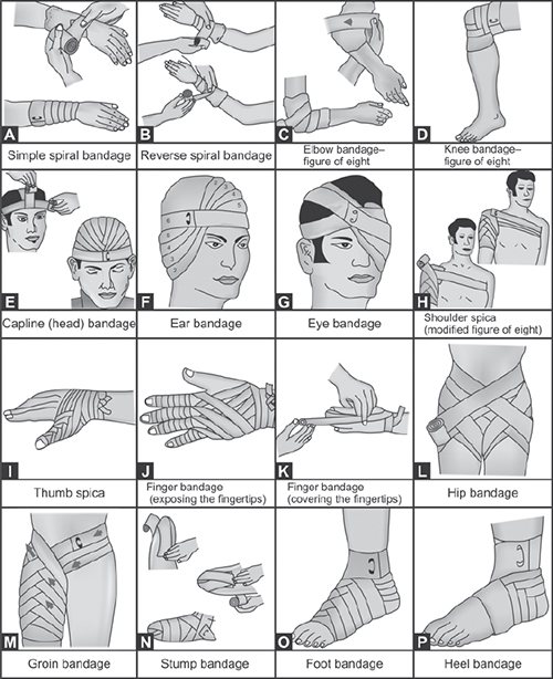 types of bandages