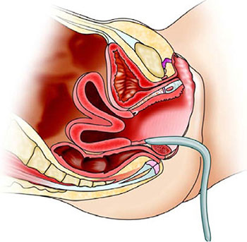 Yalangoch qizlar video, erotik porno Mushuk va eshakning yaqindan surati