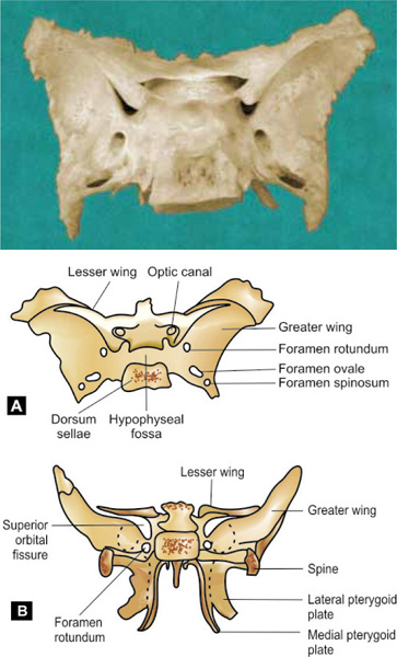 Lesser Multang Bone Lesser Wing Of Sphenoid Bone Superior View