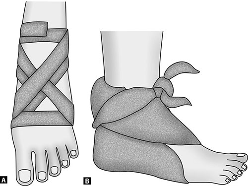 Triangular bandage for deals foot