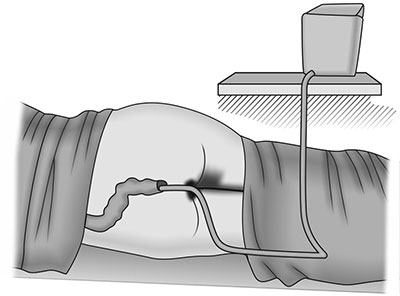 anthelmintic enema meaning