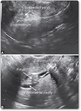 Rus hammomida gey askarlar