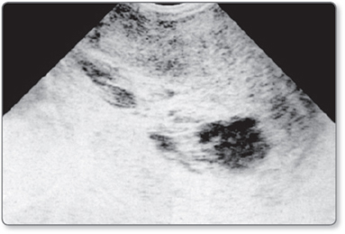 Saylov uchastkasida porno video