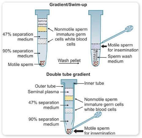 40 yoshdan oshgan yalangoch gozal ayol