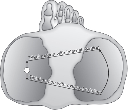 Fixed Lateral Rotation Medial And Lateral Rotation Examples