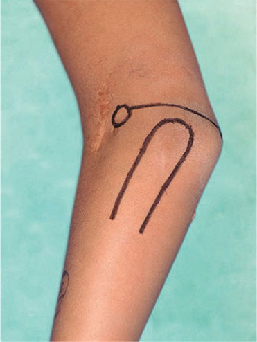 Antecubital Fossa Tattoos