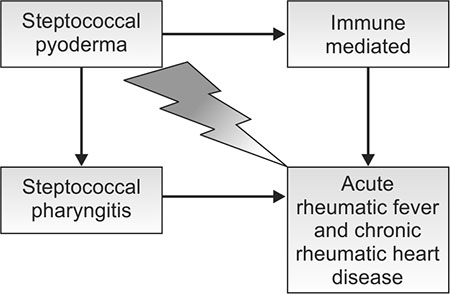 Rheumatic Fever Pathogenesis Flow Chart