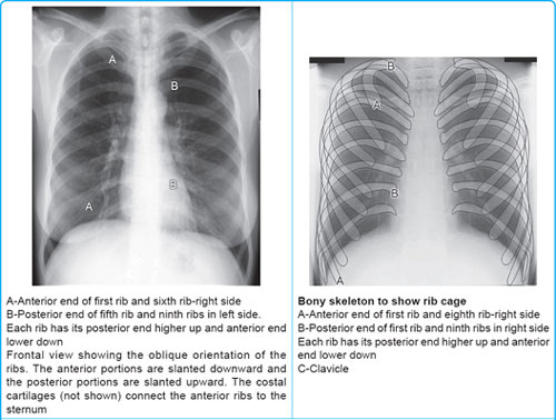 X Ray Ribs Rug Posterior Ribs Anatomy Xray