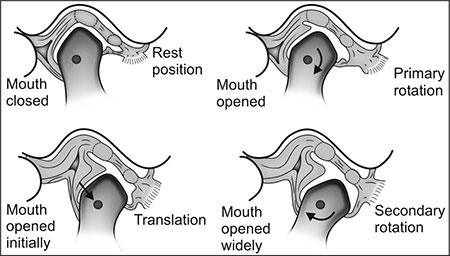 Tmj Over Rotation Rotation Movement Of Tmj