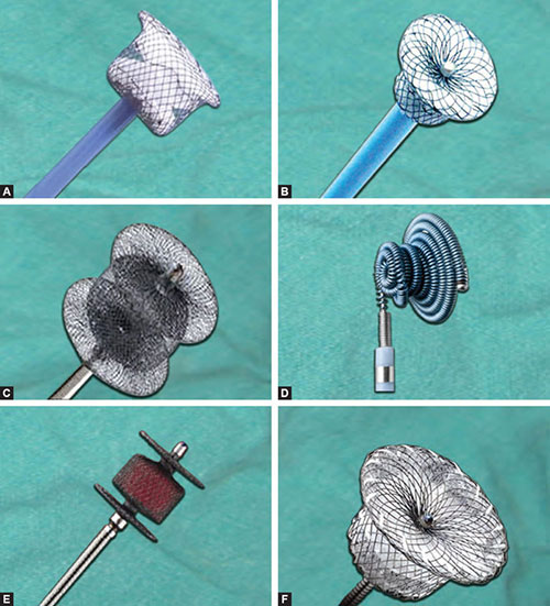 Pda Accessory Types Of Pda Devices