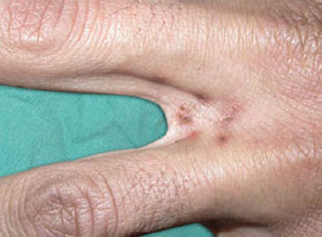 lice Doesn't Have To Be Hard. Read These 9 Tricks Go Get A Head Start.