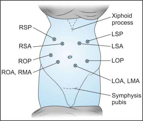 fetal heart tone