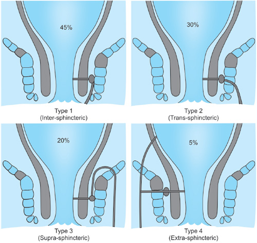 Qul anal porno onlayn