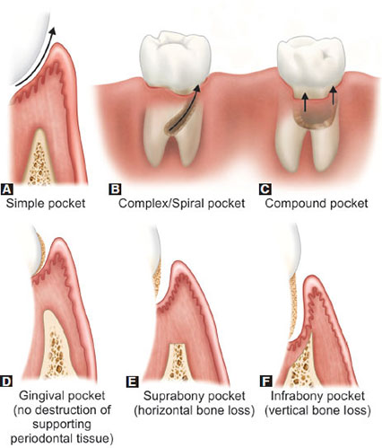 mcq carranza periodontology mcq carranza periodontology