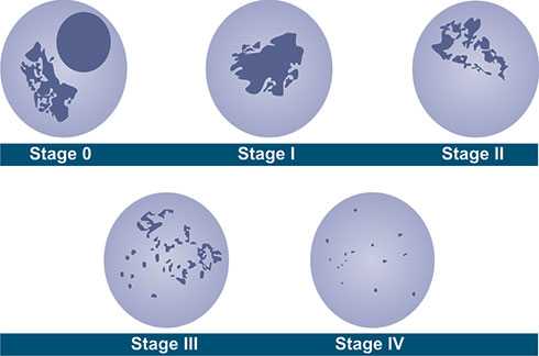 Normal Retic 2d Dataplot Types Of Reticulocytes