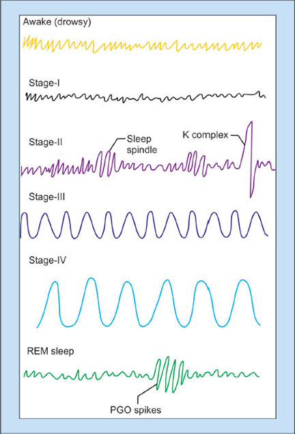 Sleep Spindles In Eeg