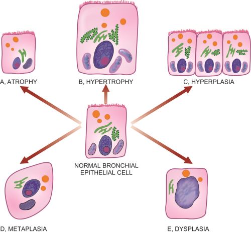 Cell Atrophy Diagram