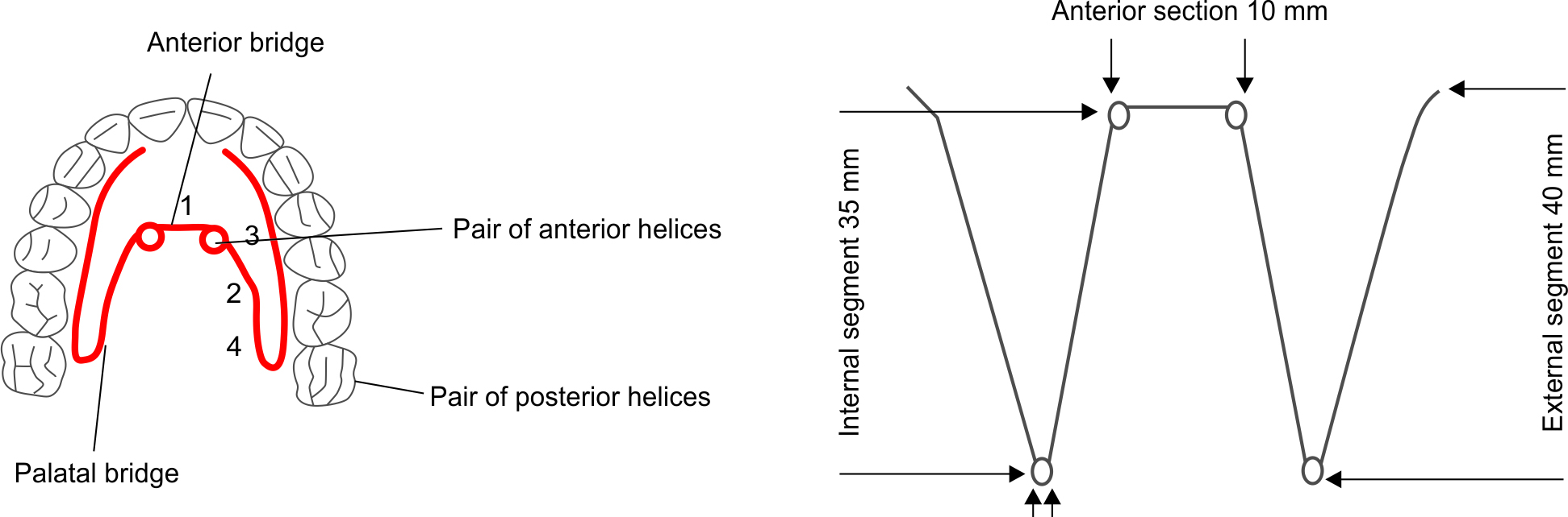 Comparison of Stress Distribution and Displacement of Skeletal, Dental