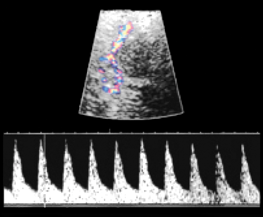 Fetal and Maternal Physiology and Ultrasound Diagnosis