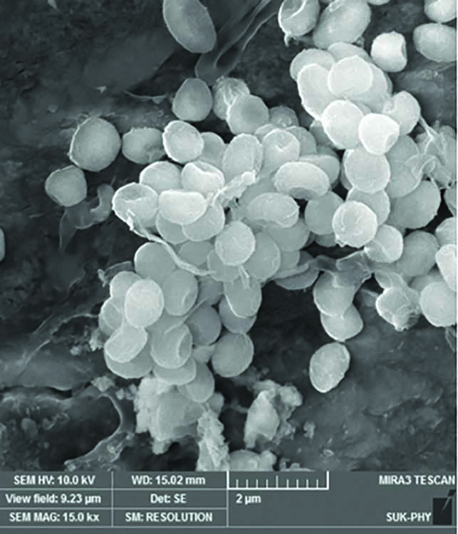 A Comparative Evaluation of Remineralizing Potential of Commonly Used