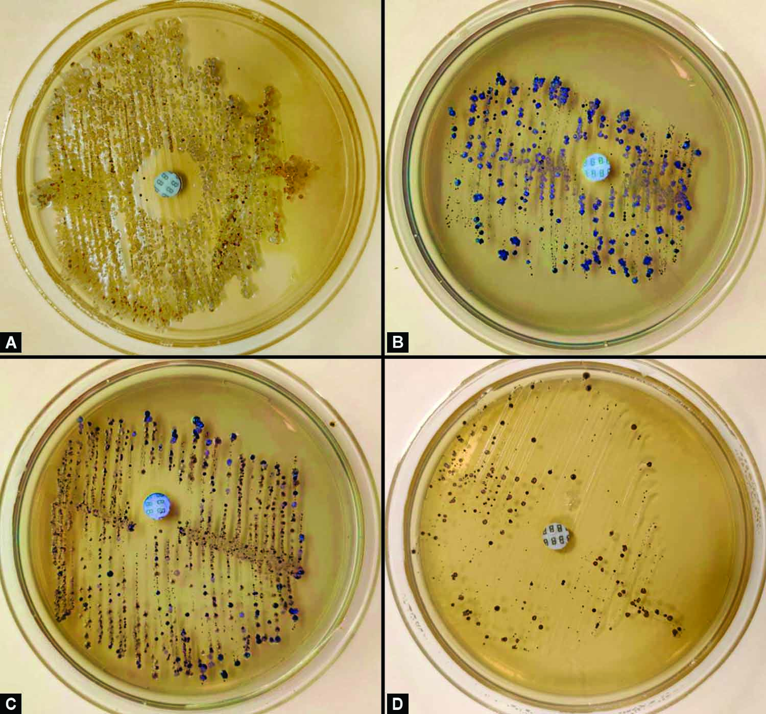 A Comparative Evaluation of Xylitol Chewing Gum and a Combination of