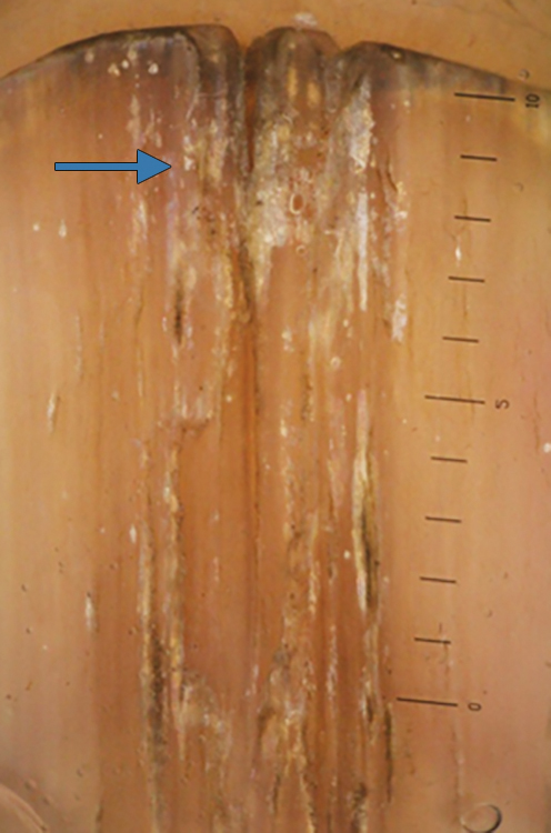 ijdy-1-11-g006.tif
