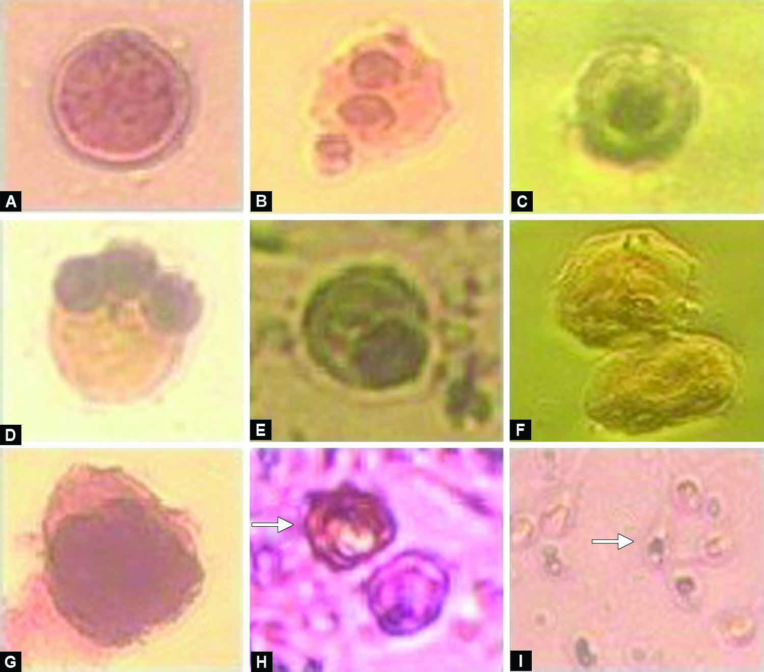 round cells in sperm