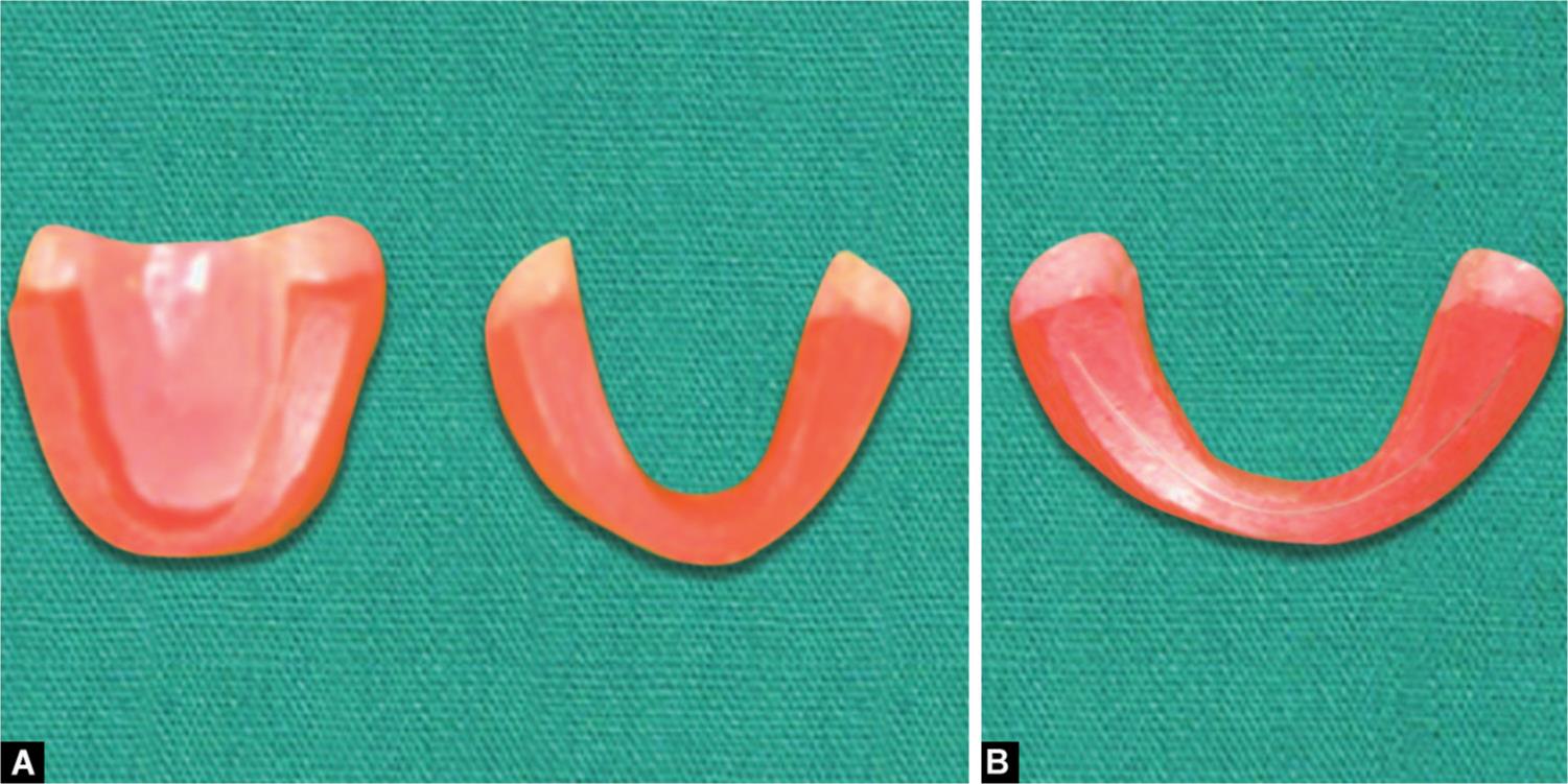 A Comparative Radiographic Evaluation of Occlusal Plane in Dentulous and Edentulous Subjects A