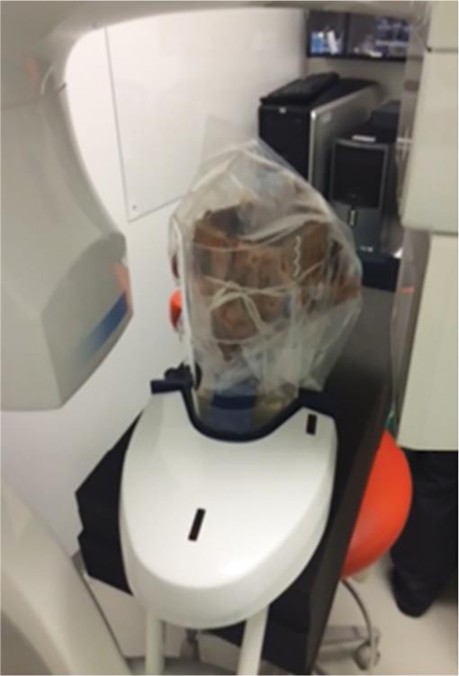 Accuracy of Conebeam Computed Tomography and Extraoral Bitewings