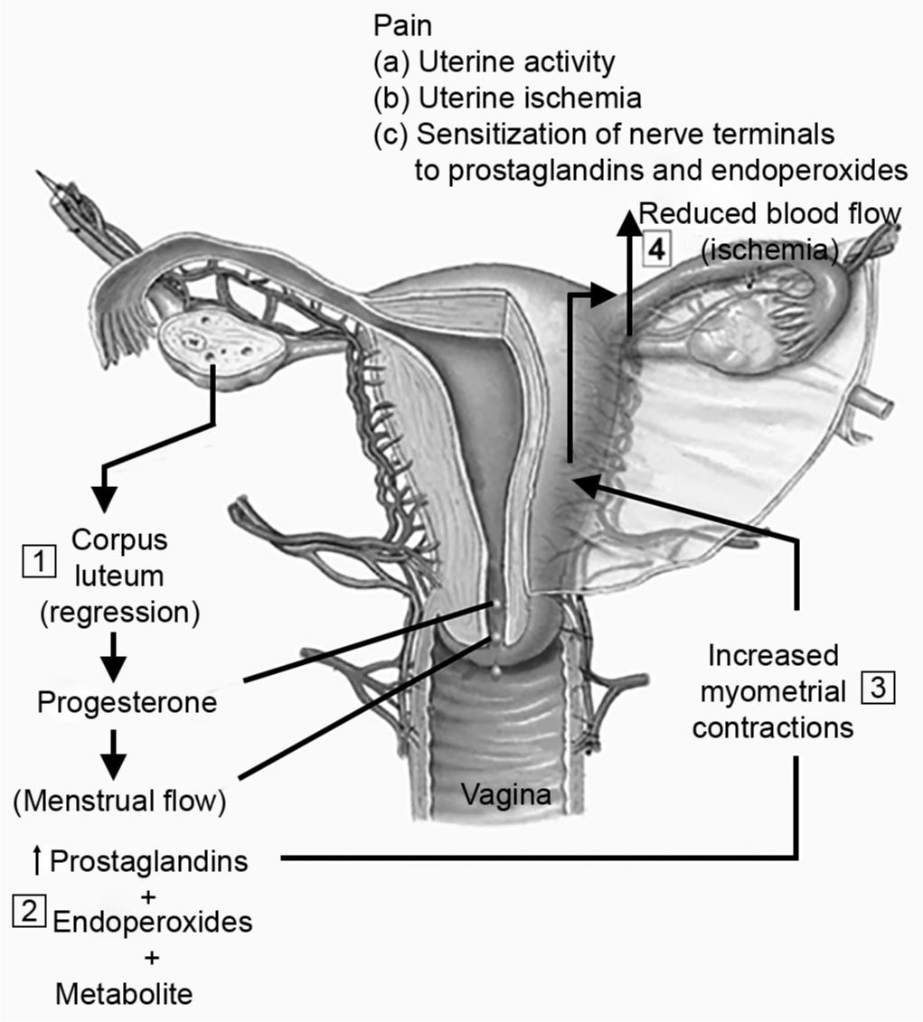 Dysmenorrhea Pathophysiology