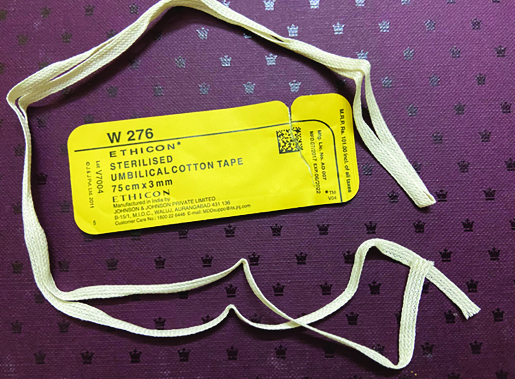 Cotton Umbilical Tape as a Sling Case Series